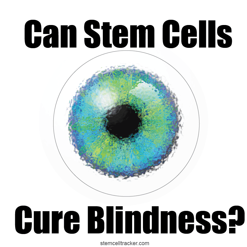 can-stem-cells-cure-blindness